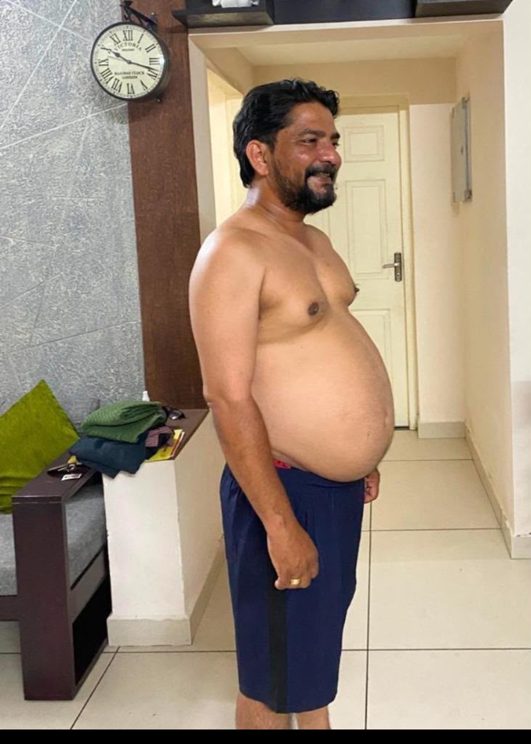 Before Transformation
